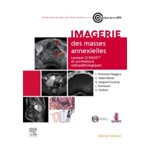 Imagerie des masses annexielles | Professeur Isabelle Thomassin-Naggara (ISBN: 9782294786266)