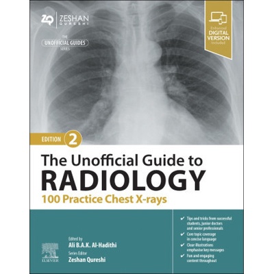 The Unofficial Guide to Radiology: 100 Practice Chest X Rays