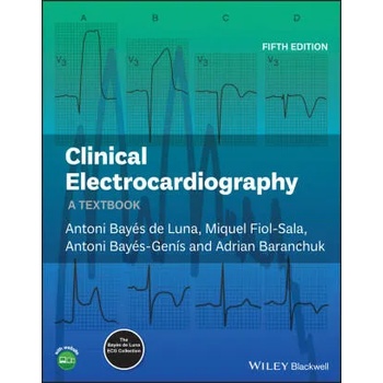 Clinical Electrocardiography - A Textbook 5e