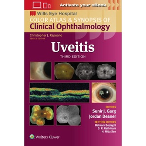 Uveitis | Garg, Sunir J (2024)