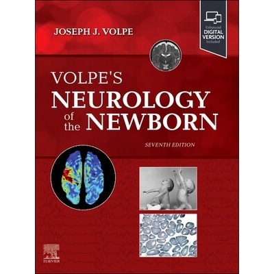 Volpe's Neurology of the Newborn - Joseph J. Volpe, Terrie E. Inder