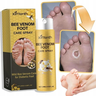 Ethereal Sprej na nohy protiplísňový zklidňující 30 ml