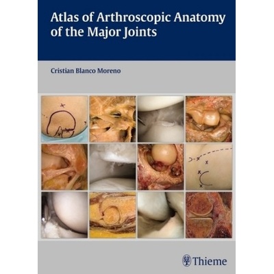 Moreno Cristian Blanco - Atlas of Arthroscopic Anatomy of Major Joints