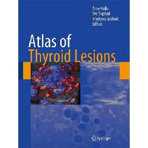 Atlas of Thyroid Lesions | Arne Heilo, Eva Sigstad, Krystyna Groeholt (ISBN: 9781441960092)