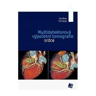 Multidetektorová výpočetní tomografie srdce - Jan Baxa, Jiří Ferda