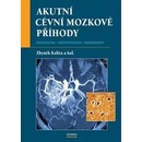 Akutní cévní mozkové příhody - Zbyněk Kalita a kolektív