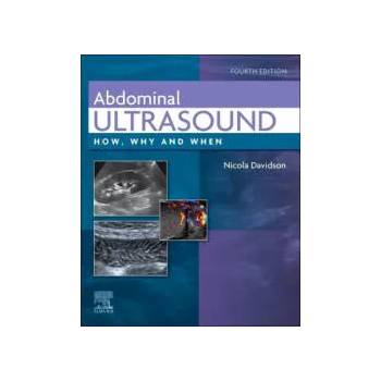 Image 1 of Abdominal Ultrasound | Nicola Davidson