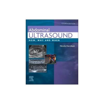 Abdominal Ultrasound | Nicola Davidson
