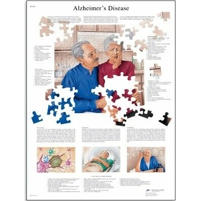 Schéma - Alzheimerova nemoc - AJ - 50x67 cm Papír s lištou