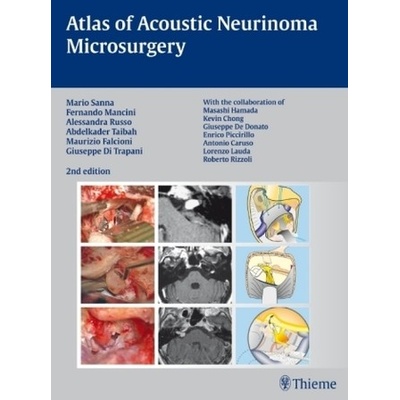 Atlas of Acoustic Neurinoma Microsurgery - Sanna, Mario