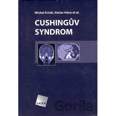 Cushingův syndrom - Michal Kršek, Václav Hána