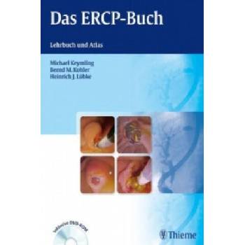 Image 1 of Das ERCP-Buch, m. DVD-ROM | Michael Keymling, Bernd M. Kohler, Heinrich J. Lübke