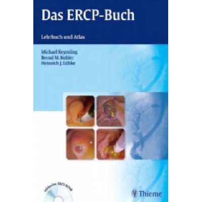 Das ERCP-Buch, m. DVD-ROM | Michael Keymling, Bernd M. Kohler, Heinrich J. Lübke