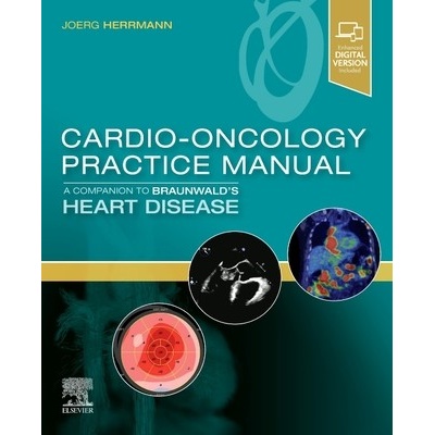 Cardio-Oncology Practice Manual: A Companion to Braunwald's Heart Disease Herrmann JoergPaperback