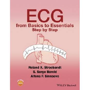 ECG from Basics to Essentials