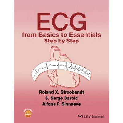 ECG from Basics to Essentials