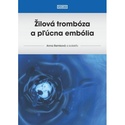Žilová trombóza a pľúcna embólia - Remková Anna a kol.
