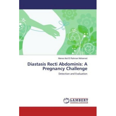Diastasis Recti Abdominis Marwa Abd El Rahman Mohamed
