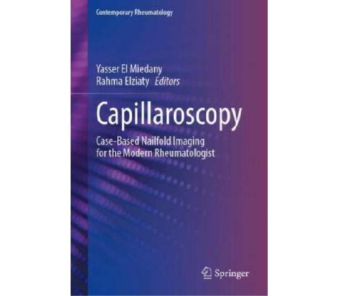 Capillaroscopy