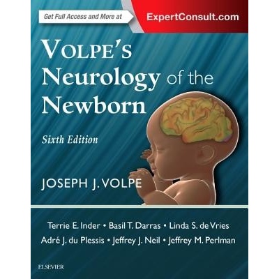 Volpes Neurology of the Newborn Volpe Joseph J.Pevná vazba