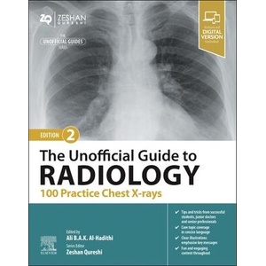 The Unofficial Guide to Radiology: 100 Practice Chest X Rays | Ali Al-Hadithi, Zeshan Dr Qureshi (ISBN: 9780443109171)
