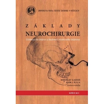 Základy neurochirurgie - Miroslav Gajdoš; Igor J. Šulla