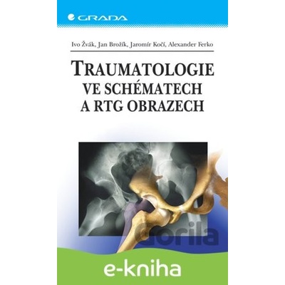 Traumatologie ve schématech a RTG obrazech - Ivo Žvák, Jan Brožík, Jaromír Kočí, Alexander Ferko