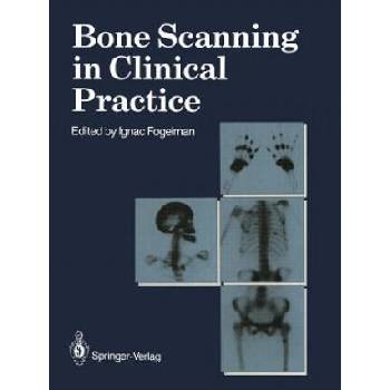 Image 1 of Bone Scanning in Clinical Practice | Ignac Fogelman