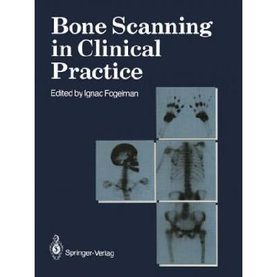 Bone Scanning in Clinical Practice | Ignac Fogelman