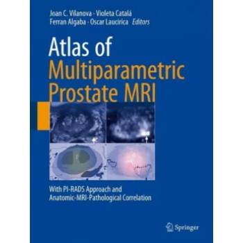 Image 1 of Atlas of Multiparametric Prostate MRI | Joan C. Vilanova, Violeta Catalá, Ferran Algaba, Oscar Laucirica