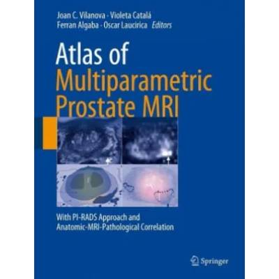 Atlas of Multiparametric Prostate MRI | Joan C. Vilanova, Violeta Catalá, Ferran Algaba, Oscar Laucirica