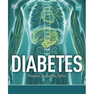 Diabetes Prevencia, diagnostika, liečba - Rosemary Walker