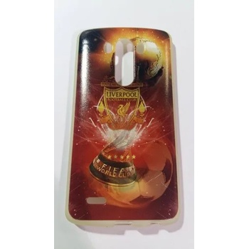 Image 1 of LG Силиконов калъф lg g3 отбори 3