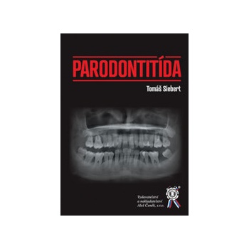 Parodontitída