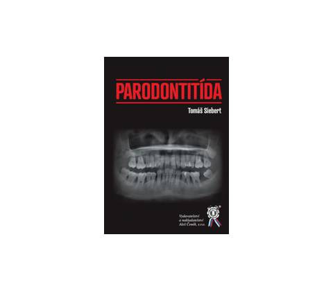 Parodontitída