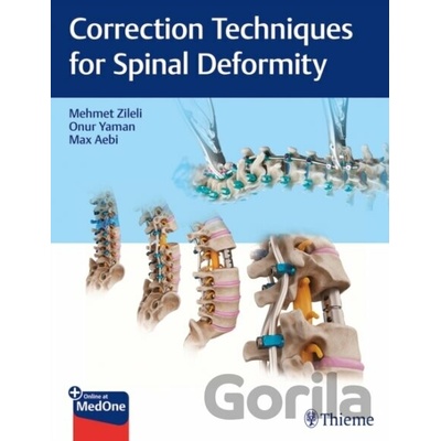 Correction Techniques for Spinal Deformity - Max Aebi, Onur Yaman, Mehmet Zileli