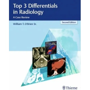 Top 3 Differentials in Radiology | William T. O'Brien (ISBN: 9781626232785)