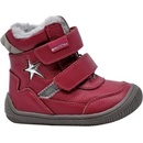 Protetika Tempra červená