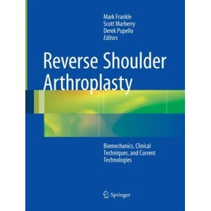 Reverse Shoulder Arthroplasty | Mark Frankle, Scott Marberry, Derek Pupello (ISBN: 9783319371535)