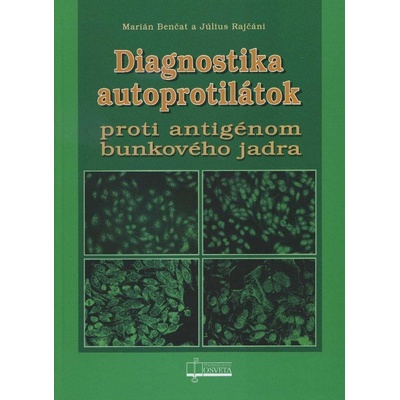 Diagnostika autoprotilátok proti antigénom bunkového jadra