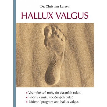 Hallux valgus