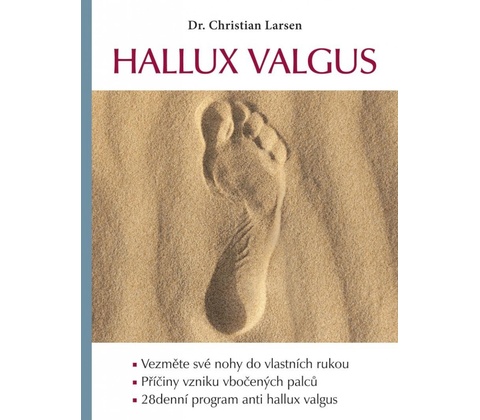 Hallux valgus