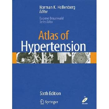 Atlas of Hypertension | Norman K. Hollenberg
