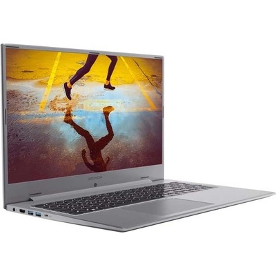 Medion Akoya S17405 MD62141
