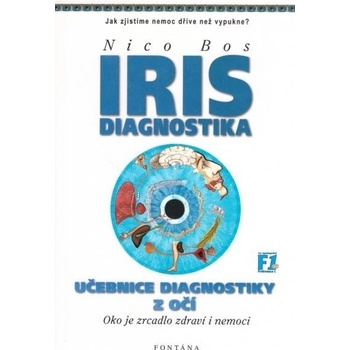 Iris diagnostika