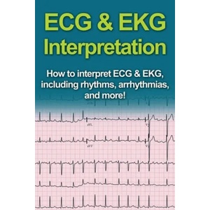 ECG & EKG Interpretation | Jeremy Pine (ISBN: 9781761030987)
