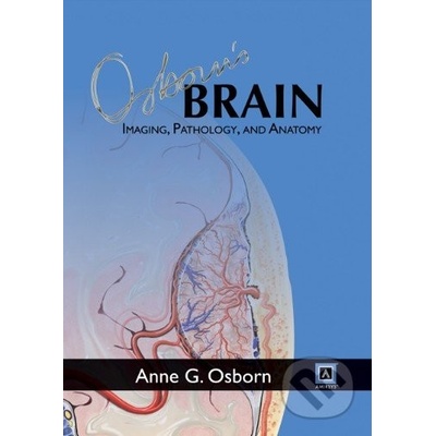 Osborn\'s Brain: Imaging, Pathology, and Anatomy - Anne G. Osborn