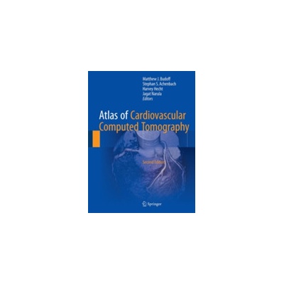 Atlas of Cardiovascular Computed TomographyMixed media product