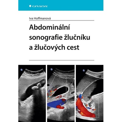 Abdominální sonografie žlučníku a žlučových cest