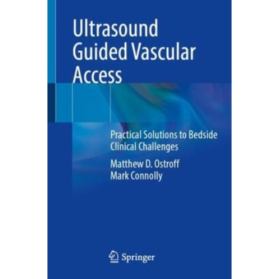 Ultrasound Guided Vascular Access